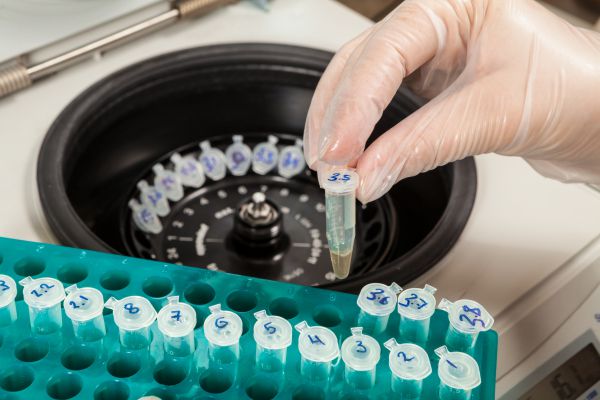 Seguridad Alimetaria